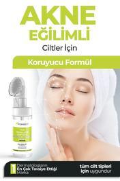 FONDEST Fırçalı Yüz Temizleme Köpüğü Siyah Nokta Ve Sivilce Karşıtı 150 ml