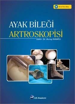 Ayak Bileği Artroskopisi