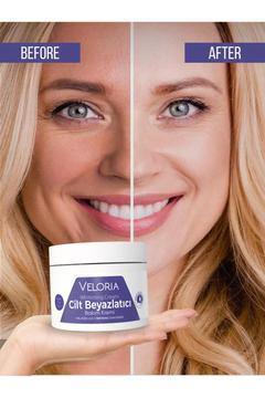 Koltuk Altı-Diz-Dirsek Ve Bikini Bölgesi Cilt Beyazlatıcı Krem 100 ml Skin Whitening Cream