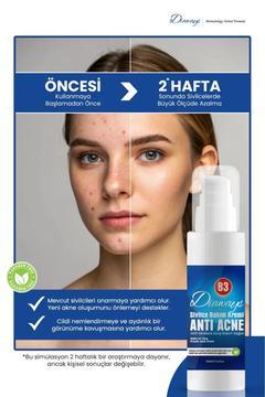 Sîvîlce ve Âkne Karşıtı,Sivilceye ve Akneye karşı kurutucu önleyici cilt yenileyici Kremi